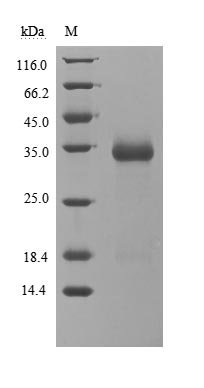 Recombinant Severe acute respiratory syndrome coronavirus 2 Spike glycoprotein (S) (G476S), partial (Active)