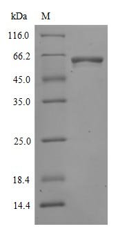 Recombinant Severe acute respiratory syndrome coronavirus 2 Spike glycoprotein (S) (N501Y), partial (Active), Severe acute respiratory syndrome coronavirus 2 (2019-nCoV) (SARS-CoV-2), Mammalian cell, C-terminal 6xHis-mFC-tagged, 55.3kDa, purity >90% as determined by SDS-PAGE.