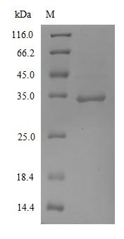 Recombinant Severe acute respiratory syndrome coronavirus 2 Spike glycoprotein (S) (K417N), partial, Severe acute respiratory syndrome coronavirus 2 (2019-nCoV) (SARS-CoV-2), Mammalian cell, C-terminal 10xHis-tagged, 27.8kDa, purity >90% as determined by SDS-PAGE.