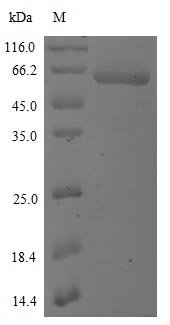 Recombinant Severe acute respiratory syndrome coronavirus 2 Spike glycoprotein (S) (K417N), partial