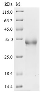 Recombinant Severe acute respiratory syndrome coronavirus 2 Spike glycoprotein (S) (K417T), partial
