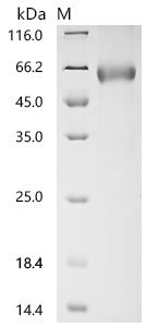 Recombinant Severe acute respiratory syndrome coronavirus 2 Spike glycoprotein (S) (K417T), partial