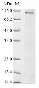 Recombinant Human Pendrin (SLC26A4) (H723R) Protein, Homo sapiens (Human), in vitro E.coli expression system, N-terminal 6xHis-tagged, 86.7kDa, purity >85% as determined by SDS-PAGE.