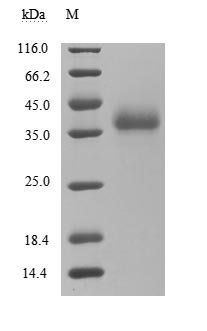 Recombinant Severe acute respiratory syndrome coronavirus Spike glycoprotein (S), partial (Active)