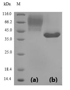 Recombinant Severe acute respiratory syndrome coronavirus 2 Spike glycoprotein (S), partial (Active), Severe acute respiratory syndrome coronavirus 2 (2019-nCoV) (SARS-CoV-2), Yeast, N-terminal 6xHis-sumostar-tagged, 38.2kDa, purity >90% as determined by SDS-PAGE.