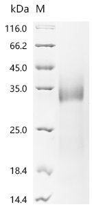 Recombinant Bovine coronavirus Spike glycoprotein (S), partial, Bovine coronavirus (strain 98TXSF-110-LUN) (BCoV-LUN) (BCV), Yeast, C-terminal 6xHis-tagged, 36.5kDa, purity >90% as determined by SDS-PAGE.