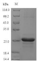 Recombinant Mouse Protein S100-A8 (S100a8)