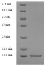 Recombinant Rat Protein S100-A8 (S100a8)