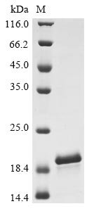 Recombinant Sheep Serum amyloid A protein (SAA1), Ovis aries (Sheep), E.coli, N-terminal 6xHis-tagged, 18.7kDa, purity >90% as determined by SDS-PAGE.