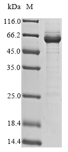 Recombinant Mouse Protein SAAL1 (Saal1)