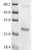 (Tris-Glycine gel) Discontinuous SDS-PAGE (reduced) with 5% enrichment gel and 15% separation gel.