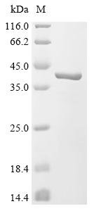 Recombinant Glycine max Seed biotin-containing protein SBP65 (SBP65), partial