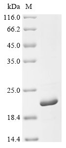 Recombinant Human herpesvirus 2 Small capsomere-interacting protein (SCP), Human herpesvirus 2 (strain HG52) (HHV-2) (Human herpes simplex virus 2), E.coli, C-terminal 6xHis-tagged, 19.1kDa, purity >95% as determined by SDS-PAGE.