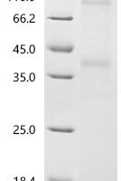 (Tris-Glycine gel) Discontinuous SDS-PAGE (reduced) with 5% enrichment gel and 15% separation gel.