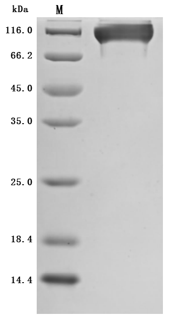 Recombinant Macaca mulatta Semaphorin-4D isoform 1 (SEMA4D), partial (Active)