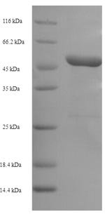 Recombinant Rat Plasminogen activator inhibitor 1 (Serpine1)
