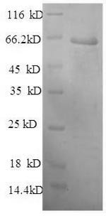 Recombinant Mouse Plasma protease C1 inhibitor (Serping1), partial