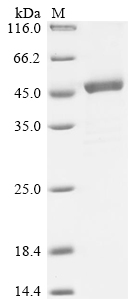 Recombinant Rat Sharpin (Sharpin), Rattus norvegicus (Rat), E.coli, N-terminal 10xHis-tagged and C-terminal Myc-tagged, 47.7kDa, purity >85% as determined by SDS-PAGE.