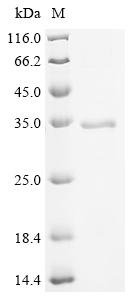 Recombinant Mouse Sialate O-acetylesterase (Siae), partial
