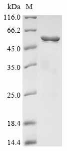 Recombinant Streptococcus agalactiae Group B streptococcal surface immunogenic protein (sip)