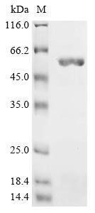 Recombinant Salmonella typhimurium Cell invasion protein sipD (sipD)