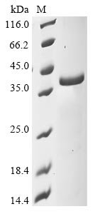 Recombinant Mouse NAD-dependent protein deacylase sirtuin-5, mitochondrial (Sirt5), Mus musculus (Mouse), E.coli, N-terminal 10xHis-tagged and C-terminal Myc-tagged, 37.6kDa, purity >85% as determined by SDS-PAGE.