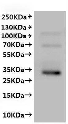 Recombinant Mouse Aquaporin-4 (Aqp4)-VLPs Protein, Mus musculus (Mouse), Mammalian cell, C-terminal 10xHis-tagged, 35.9kDa, purity >The purity information is not available for VLPs proteins.