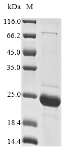 Recombinant Pig Alpha-synuclein (SNCA), Sus scrofa (Pig), E.coli, N-terminal 10xHis-tagged and C-terminal Myc-tagged, 22.0kDa, purity >85% as determined by SDS-PAGE.