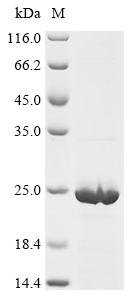 Recombinant Mouse Gamma-synuclein (Sncg), Mus musculus (Mouse), E.coli, C-terminal 6xHis-tagged, 20.2kDa, purity >85% as determined by SDS-PAGE.