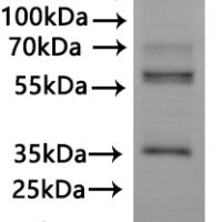 CSB-MP622766HU is detected by Mouse anti-6*His monoclonal antibody