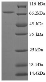 Recombinant Escherichia coli Biosynthetic arginine decarboxylase (speA), partial