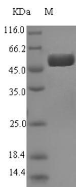 Recombinant Escherichia coli Agmatinase (speB)