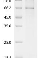 (Tris-Glycine gel) Discontinuous SDS-PAGE (reduced) with 5% enrichment gel and 15% separation gel.