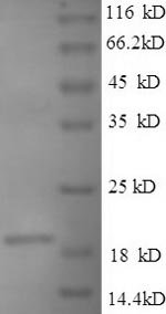 Recombinant Bacillus anthracis Single-stranded DNA-binding protein (ssb)