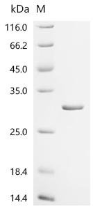 Recombinant Escherichia coli Phospholipase A1 (pldA) Protein, Escherichia coli (strain K12), in vitro E.coli expression system, N-terminal 10xHis-tagged, 32.3kDa, purity >95% as determined by SDS-PAGE.