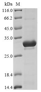 Recombinant Escherichia coli O157:H7 Metalloprotease stcE (stcE), partial, Escherichia coli O157:H7, E.coli, N-terminal 6xHis-tagged, 32.3kDa, purity >85% as determined by SDS-PAGE.