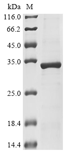 Recombinant Escherichia coli O157:H7 Metalloprotease stcE (stcE), partial