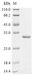 Recombinant Mouse Stathmin-2 (Stmn2), Mus musculus (Mouse), E.coli, C-terminal 6xHis-tagged, 27.7kDa, purity >95% as determined by SDS-PAGE.