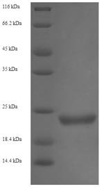 Recombinant Enterobacteria phage H19B Shiga-like toxin 1 subunit B (stxB)
