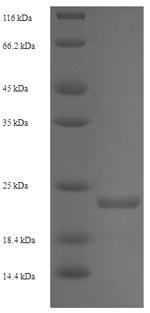 Recombinant Enterobacteria phage 933W Shiga-like toxin 2 subunit B (stxB2)