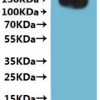 CSB-MP733578HU(A4)e4 is detected by Mouse anti-GFP monoclonal antibody.