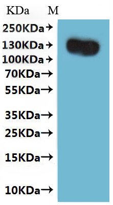 CSB-MP733578HU(A4)e4 is detected by Mouse anti-GFP monoclonal antibody.