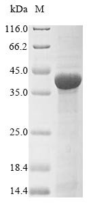 Recombinant Neisseria meningitidis serogroup B Transferrin-binding protein 1 (tbp1), partial, Neisseria meningitidis serogroup B (strain MC58), E.coli, N-terminal 10xHis-tagged and C-terminal Myc-tagged, 37.0kDa, purity >85% as determined by SDS-PAGE.