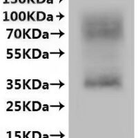 CSB-MP773043HU is detected by Mouse anti-6*His monoclonal antibody