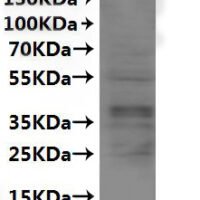 CSB-MP006236HU is detected by Mouse anti-6*His monoclonal antibody.
