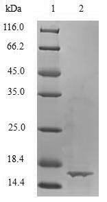 Recombinant Bovine Transforming growth factor beta-1 proprotein (TGFB1), partial, Bos taurus (Bovine), E.coli, N-terminal 6xHis-tagged, 16.8kDa, purity >90% as determined by SDS-PAGE.