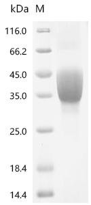 Recombinant Rat Transforming growth factor beta-1 proprotein (Tgfb1), partial