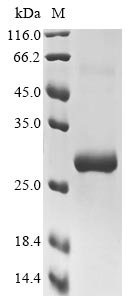 Recombinant Mouse Toll-like receptor 11 (Tlr11), partial