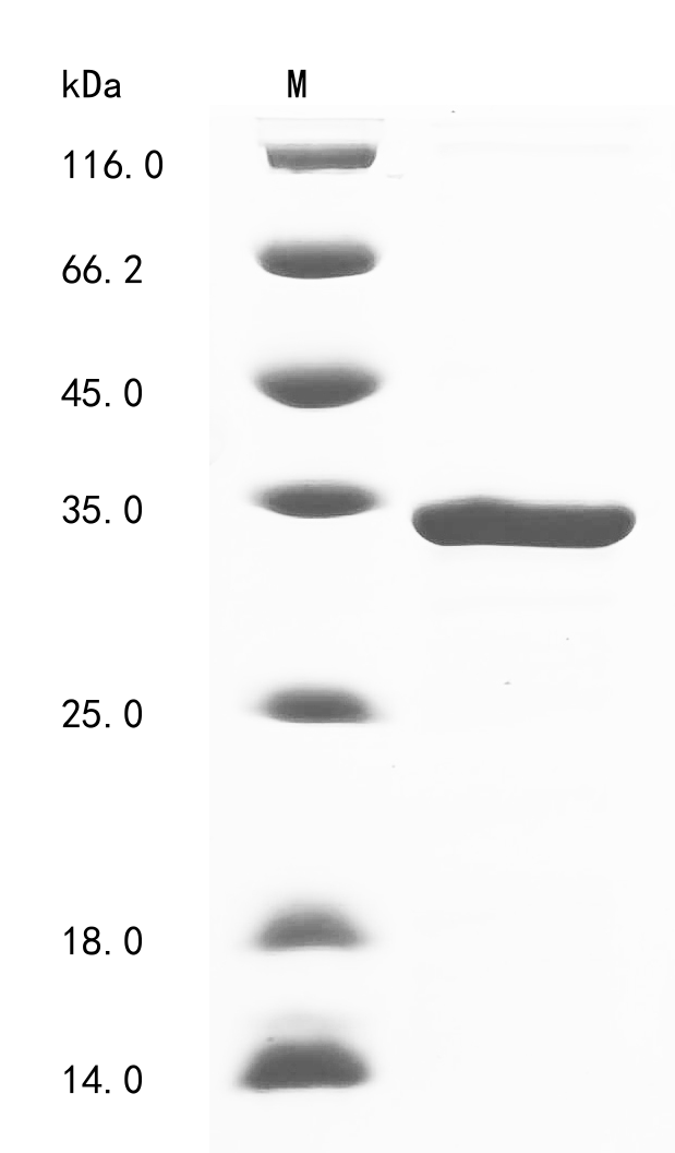 Recombinant Horse Troponin I, cardiac muscle (TNNI3)