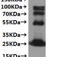 CSB-MP5518MO is detected by Mouse anti-6*His monoclonal antibody.